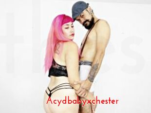 Acydbabyxchester